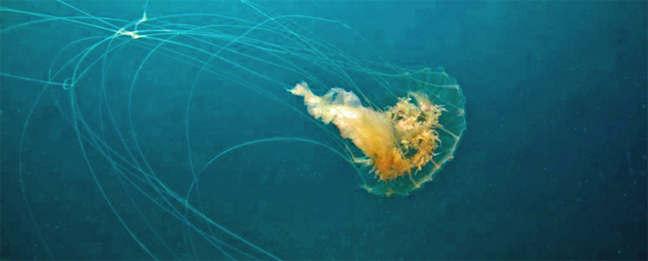 Hawaii Jellyfish Sting