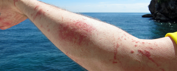 Hawaiian Box Jellyfish